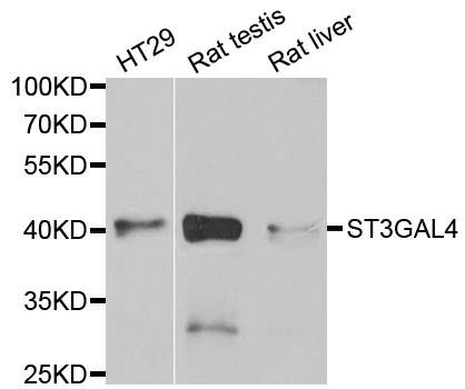 ST3GAL4 / ST3Gal IV Antibody - Western blot analysis of extracts of various cell lines.