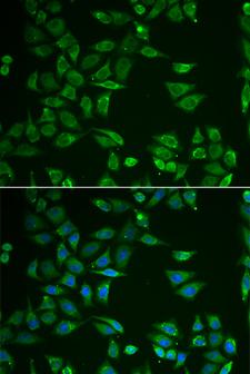 ST3GAL4 / ST3Gal IV Antibody - Immunofluorescence analysis of HeLa cells.