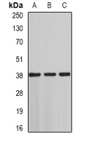 ST3GAL4 / ST3Gal IV Antibody - Western blot analysis of ST3GAL4 expression in HT29 (A); rat testis (B); rat liver (C) whole cell lysates.