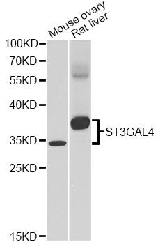ST3GAL4 / ST3Gal IV Antibody - Western blot analysis of extracts of various cell lines, using ST3GAL4 antibody at 1:1000 dilution. The secondary antibody used was an HRP Goat Anti-Rabbit IgG (H+L) at 1:10000 dilution. Lysates were loaded 25ug per lane and 3% nonfat dry milk in TBST was used for blocking. An ECL Kit was used for detection and the exposure time was 60s.