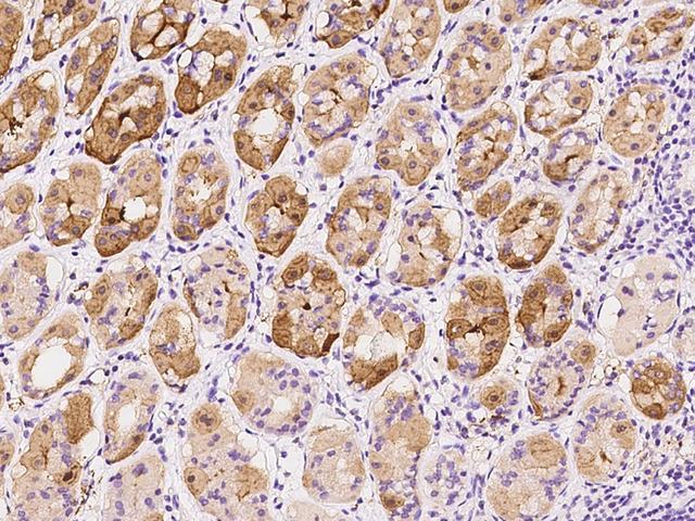 ST3GAL4 / ST3Gal IV Antibody - Immunochemical staining of human ST3GAL4 in human stomach with rabbit polyclonal antibody at 1:100 dilution, formalin-fixed paraffin embedded sections.