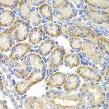 ST3GAL4 / ST3Gal IV Antibody - Immunohistochemistry of paraffin-embedded Rat kidney using ST3GAL4 Polyclonal Antibody at dilution of 1:200 (40x lens).