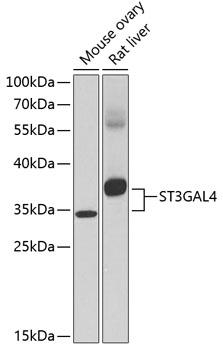 ST3GAL4 / ST3Gal IV Antibody - Western blot analysis of extracts of various cell lines using ST3GAL4 Polyclonal Antibody at dilution of 1:1000.