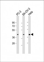 ST3GAL4 / ST3Gal IV Antibody - All lanes: Anti-ST3GAL4 Antibody (N-Term) at 1:1000-1:2000 dilution Lane 1: PC-3 whole cell lysate Lane 2: SK-OV-3 whole cell lysate Lane 3: Hela whole cell lysate Lysates/proteins at 20 µg per lane. Secondary Goat Anti-Rabbit IgG, (H+L), Peroxidase conjugated at 1/10000 dilution. Predicted band size: 38 kDa Blocking/Dilution buffer: 5% NFDM/TBST.