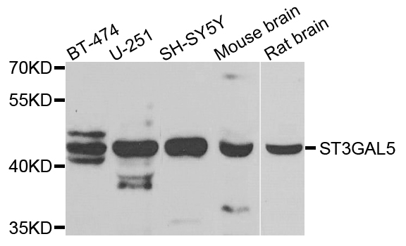 ST3GAL5 / GM3 Synthase Antibody - Western blot analysis of extracts of various cells.