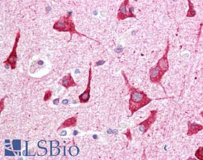 ST3GAL5 / GM3 Synthase Antibody - Human Brain, Cortex: Formalin-Fixed, Paraffin-Embedded (FFPE)