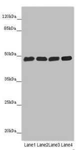 ST3GAL5 / GM3 Synthase Antibody - Western blot All Lanes: ST3GAL5 antibody at 4.8 ug/ml Lane 1: Hela whole cell lysate Lane 2: 293T whole cell lysate Lane 3: Jurkat whole cell lysate Lane 4: U251 whole cell lysate Secondary Goat polyclonal to rabbit IgG at 1/10000 dilution Predicted band size: 48,46 kDa Observed band size: 48 kDa