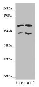 ST3GAL5 / GM3 Synthase Antibody - Western blot All Lanes: ST3GAL5 antibody at 6.2 ug/ml Lane 1: K562 whole cell lysate Lane 2: U251 whole cell lysate Secondary Goat polyclonal to rabbit IgG at 1/10000 dilution Predicted band size: 48,46 kDa Observed band size: 48,60 kDa