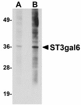 ST3GAL6 Antibody - Western blot of ST3gal6 in HeLa cell lysate with ST3gal6 antibody at (A) 1 and (B) 2 ug/ml. Below: Immunocytochemistry of ST3gal6 in HeLa cells with ST3gal6 antibody at 5 ug/ml.
