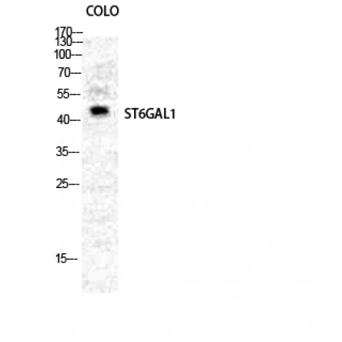 ST6GAL1 / CD75 Antibody - Western blot of CD75 antibody