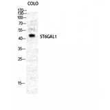 ST6GAL1 / CD75 Antibody - Western blot of CD75 antibody