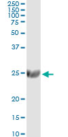 ST6GAL1 / CD75 Antibody - Immunoprecipitation of ST6GAL1 transfected lysate using anti-ST6GAL1 monoclonal antibody and Protein A Magnetic Bead, and immunoblotted with ST6GAL1 rabbit polyclonal antibody.