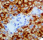 ST6GAL1 / CD75 Antibody - IHC of CD75 on FFPE Liver Tissue. This image was taken for the unmodified form of this product. Other forms have not been tested.