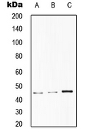 ST6GAL1 / CD75 Antibody - Western blot analysis of CD75 expression in HepG2 (A); HeLa (B); RAW264.7 (C) whole cell lysates.