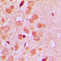 ST6GAL1 / CD75 Antibody - Immunohistochemical analysis of CD75 staining in human brain formalin fixed paraffin embedded tissue section. The section was pre-treated using heat mediated antigen retrieval with sodium citrate buffer (pH 6.0). The section was then incubated with the antibody at room temperature and detected using an HRP conjugated compact polymer system. DAB was used as the chromogen. The section was then counterstained with hematoxylin and mounted with DPX.