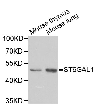 ST6GAL1 / CD75 Antibody - Western blot analysis of extracts of various cell lines.