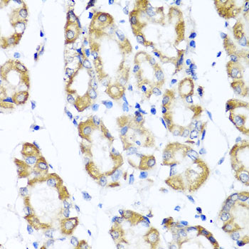 ST6GAL1 / CD75 Antibody - Immunohistochemistry of paraffin-embedded human stomach tissue.