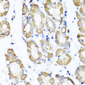 ST6GAL1 / CD75 Antibody - Immunohistochemistry of paraffin-embedded human stomach tissue.