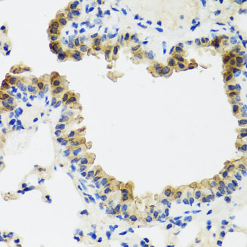 ST6GAL1 / CD75 Antibody - Immunohistochemistry of paraffin-embedded mouse lung tissue.