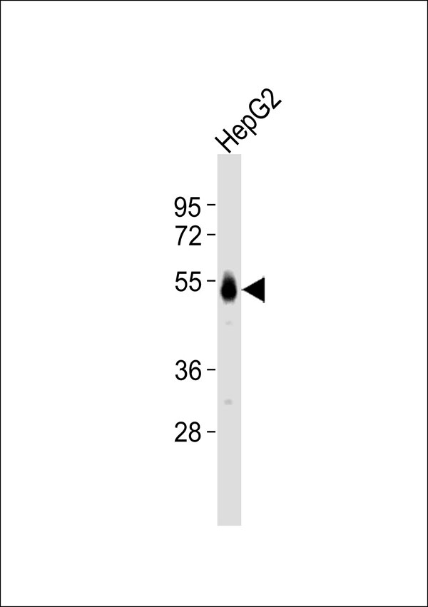 ST6GAL1 / CD75 Antibody - Anti-CD75 Antibody at 1:1000 dilution + HepG2 whole cell lysates Lysates/proteins at 20 ug per lane. Secondary Goat Anti-Rabbit IgG, (H+L),Peroxidase conjugated at 1/10000 dilution Predicted band size : 47 kDa Blocking/Dilution buffer: 5% NFDM/TBST.