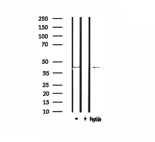 ST6GAL1 / CD75 Antibody