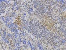 ST6GAL1 / CD75 Antibody - 1:100 staining human lymph node tissue by IHC-P. The sample was formaldehyde fixed and a heat mediated antigen retrieval step in citrate buffer was performed. The sample was then blocked and incubated with the antibody for 1.5 hours at 22°C. An HRP conjugated goat anti-rabbit antibody was used as the secondary.