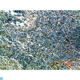 ST6GAL1 / CD75 Antibody - Immunohistochemical analysis of paraffin-embedded human-tonsils, antibody was diluted at 1:200.