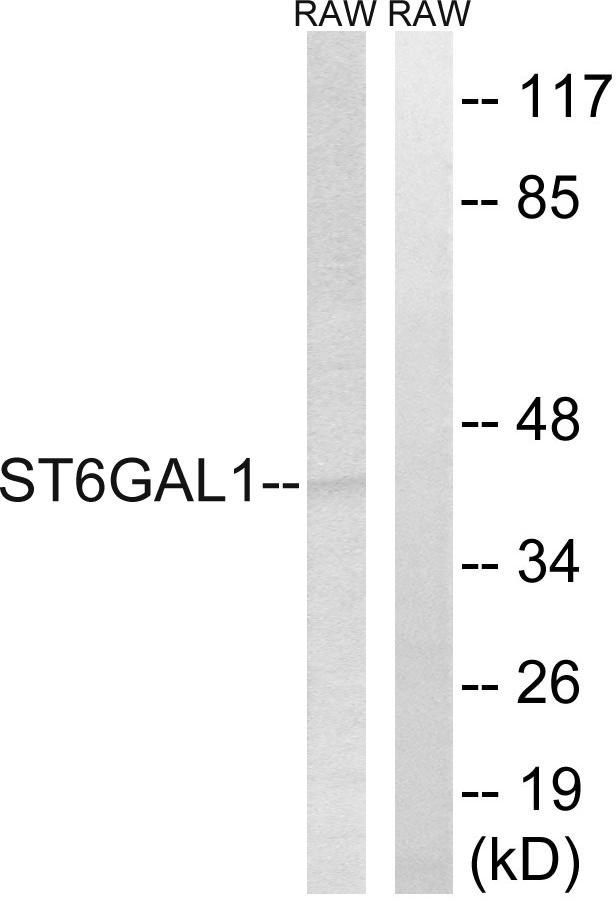 ST6GAL1 / CD75 Antibody - Western blot analysis of extracts from RAW264.7 cells, using ST6GAL1 antibody.