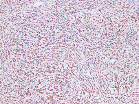ST6GAL1 / CD75 Antibody - Immunohistochemistry of paraffin-embedded Rat liver using CD75 Polyclonl Antibody at dilution of 1:200(100×).