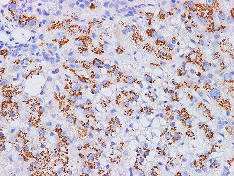 ST6GAL1 / CD75 Antibody - Immunohistochemistry of paraffin-embedded Rat liver using CD75 Polyclonl Antibody at dilution of 1:200(400×).