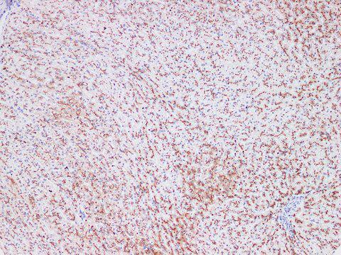 ST6GAL1 / CD75 Antibody - Immunohistochemistry of paraffin-embedded Human liver using CD75 Polyclonl Antibody at dilution of 1:200(100×).