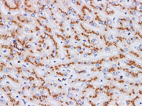 ST6GAL1 / CD75 Antibody - Immunohistochemistry of paraffin-embedded Human liver using CD75 Polyclonl Antibody at dilution of 1:200(400×).