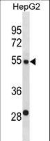 ST6GAL2 Antibody - ST6GAL2 Antibody western blot of HepG2 cell line lysates (35 ug/lane). The ST6GAL2 antibody detected the ST6GAL2 protein (arrow).