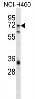 ST6GALNAC1 Antibody - ST6GALNAC1 Antibody western blot of NCI-H460 cell line lysates (35 ug/lane). The ST6GALNAC1 antibody detected the ST6GALNAC1 protein (arrow).