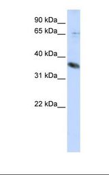 ST6GALNAC1 Antibody - HepG2 cell lysate. Antibody concentration: 1.0 ug/ml. Gel concentration: 12%.  This image was taken for the unconjugated form of this product. Other forms have not been tested.