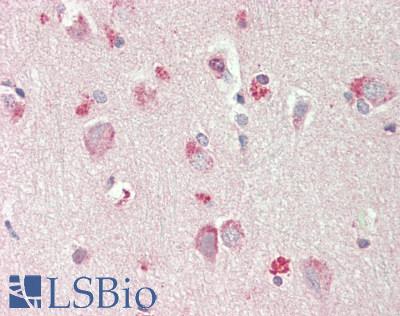 ST6GALNAC1 Antibody - Human Brain, Cortex: Formalin-Fixed, Paraffin-Embedded (FFPE).  This image was taken for the unconjugated form of this product. Other forms have not been tested.