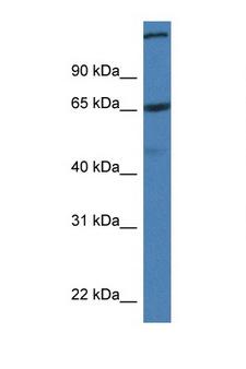 ST6GALNAC1 Antibody - ST6GALNAC1 antibody Western blot of Mouse Pancreas lysate. Antibody concentration 1 ug/ml.  This image was taken for the unconjugated form of this product. Other forms have not been tested.
