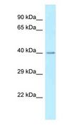 ST6GALNAC2 Antibody - ST6GALNAC2 antibody Western Blot of Rat Liver.  This image was taken for the unconjugated form of this product. Other forms have not been tested.