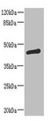 ST6GALNAC2 Antibody - Western blot All lanes: ST6GALNAC2 antibody at 8µg/ml + MCF-7 whole cell lysate Secondary Goat polyclonal to rabbit IgG at 1/10000 dilution Predicted band size: 42 kDa Observed band size: 42 kDa