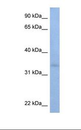 ST6GALNAC3 Antibody - HepG2 cell lysate. Antibody concentration: 1.0 ug/ml. Gel concentration: 12%.  This image was taken for the unconjugated form of this product. Other forms have not been tested.