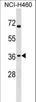 ST6GALNAC4 Antibody - ST6GALNAC4 Antibody western blot of NCI-H460 cell line lysates (35 ug/lane). The ST6GALNAC4 antibody detected the ST6GALNAC4 protein (arrow).