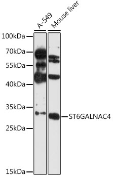 ST6GALNAC4 Antibody - Western blot analysis of extracts of various cell lines, using ST6GALNAC4 antibody at 1:3000 dilution. The secondary antibody used was an HRP Goat Anti-Rabbit IgG (H+L) at 1:10000 dilution. Lysates were loaded 25ug per lane and 3% nonfat dry milk in TBST was used for blocking. An ECL Kit was used for detection and the exposure time was 90s.