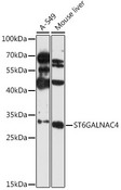 ST6GALNAC4 Antibody - Western blot analysis of extracts of various cell lines, using ST6GALNAC4 antibody at 1:3000 dilution. The secondary antibody used was an HRP Goat Anti-Rabbit IgG (H+L) at 1:10000 dilution. Lysates were loaded 25ug per lane and 3% nonfat dry milk in TBST was used for blocking. An ECL Kit was used for detection and the exposure time was 90s.
