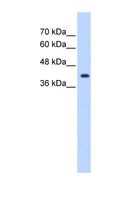 ST6GALNAC5 Antibody - Jurkat cell lysate. Antibody concentration: 1.25 ug/ml. Gel concentration: 12%.  This image was taken for the unconjugated form of this product. Other forms have not been tested.