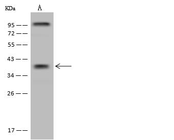 ST6GALNAC5 Antibody - Anti-ST6GALNAC5 rabbit polyclonal antibody at 1:500 dilution. Lane A: U-251 MG Whole Cell Lysate. Lysates/proteins at 30 ug per lane. Secondary: Goat Anti-Rabbit IgG (H+L)/HRP at 1/10000 dilution. Developed using the ECL technique. Performed under reducing conditions. Predicted band size: 38 kDa. Observed band size: 38 kDa.