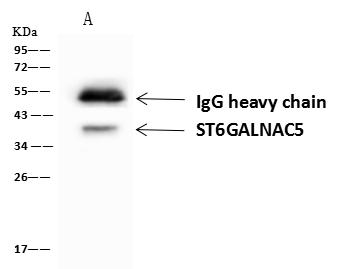 ST6GALNAC5 Antibody - ST6GALNAC5 was immunoprecipitated using: Lane A: 0.5 mg U251MG Whole Cell Lysate. 4 uL anti-ST6GALNAC5 rabbit polyclonal antibody and 60 ug of Immunomagnetic beads Protein A/G. Primary antibody: Anti-ST6GALNAC5 rabbit polyclonal antibody, at 1:100 dilution. Secondary antibody: Goat Anti-Rabbit IgG (H+L)/HRP at 1/10000 dilution. Developed using the ECL technique. Performed under reducing conditions. Predicted band size: 38 kDa. Observed band size: 38 kDa.