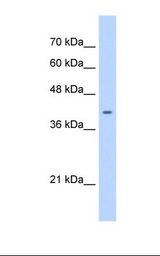 ST6GALNAC6 Antibody - HepG2 cell lysate. Antibody concentration: 0.5 ug/ml. Gel concentration: 12%.  This image was taken for the unconjugated form of this product. Other forms have not been tested.