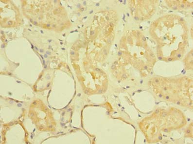 ST6GALNAC6 Antibody - Immunohistochemistry of paraffin-embedded human kidney tissue using antibody at dilution of 1:100.