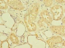 ST6GALNAC6 Antibody - Immunohistochemistry of paraffin-embedded human kidney tissue using antibody at dilution of 1:100.