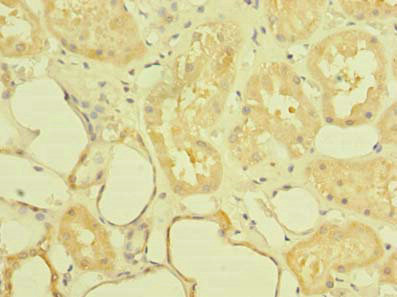 ST6GALNAC6 Antibody - Immunohistochemistry of paraffin-embedded human kidney tissue using ST6GALNAC6 Antibody at dilution of 1:100